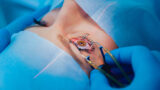 Photonics in Medical Imaging: Advances and Applications