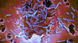 Nanoscale Imaging: Unveiling the Invisible World
