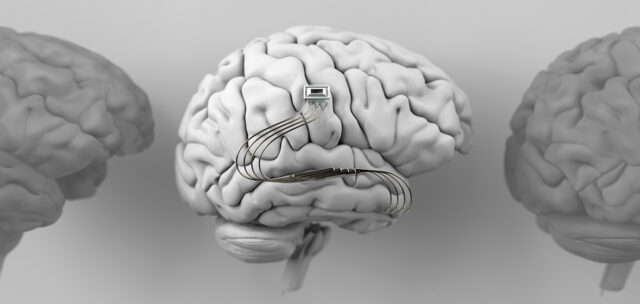 Neurotechnology: Unlocking the Potential of the Human Brain